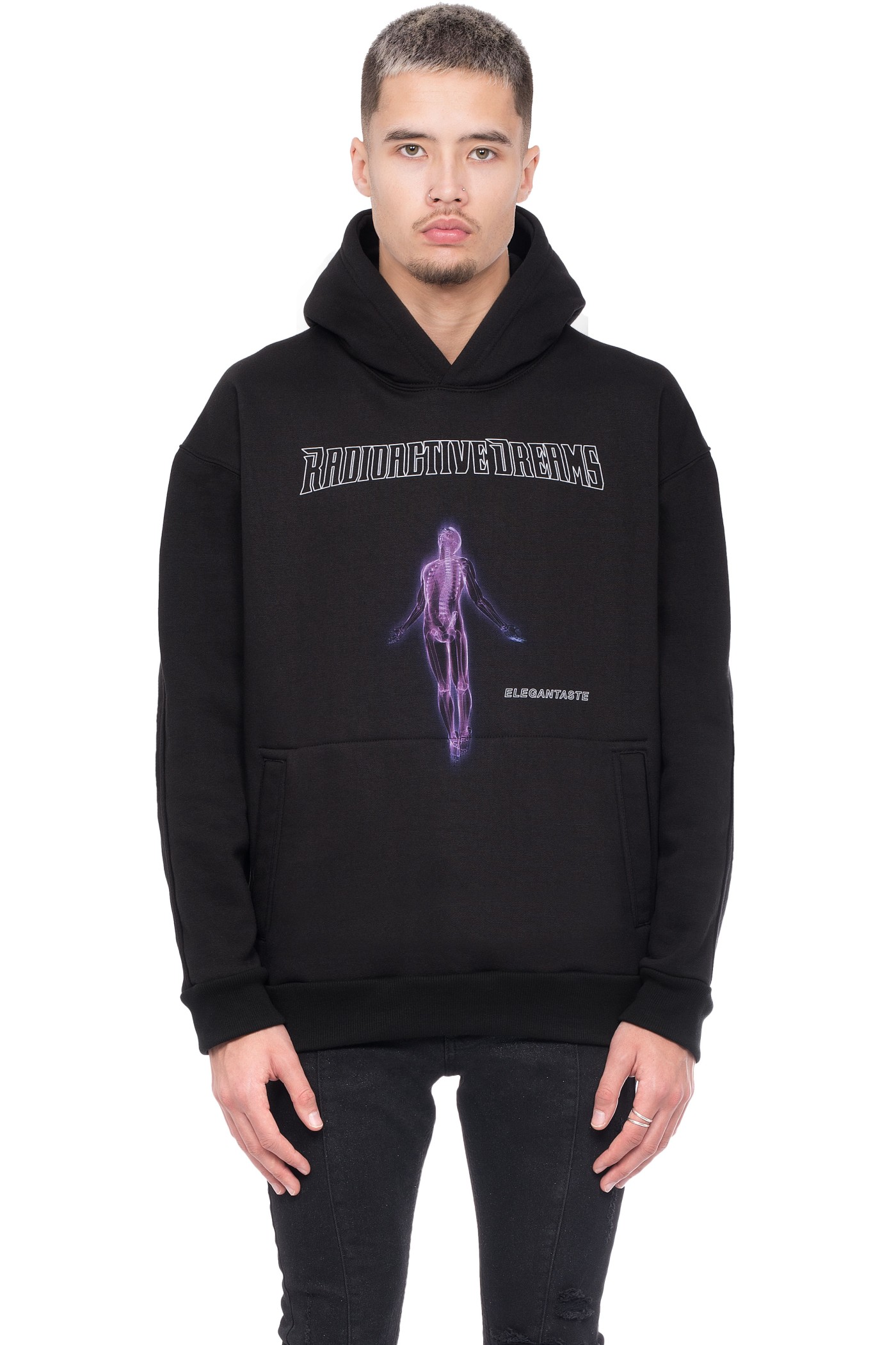 Radioactive Dreams Hoodie - Black